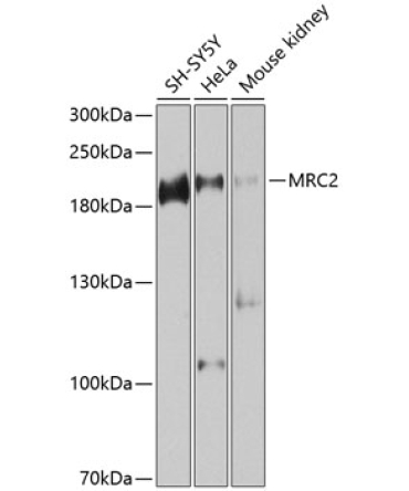 MRC2 Rabbit Polyclonal Antibody