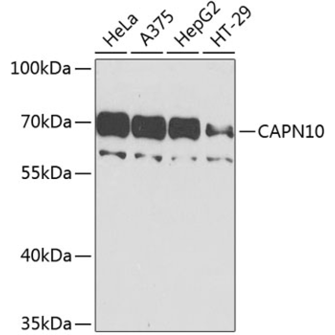 CAPN10 Rabbit Polyclonal Antibody