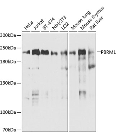 PBRM1 Rabbit Polyclonal Antibody