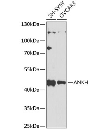 ANKH Rabbit Polyclonal Antibody