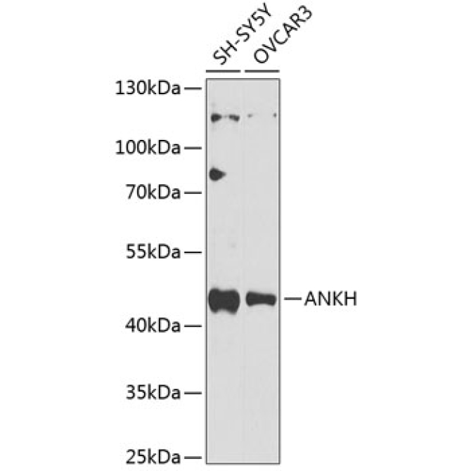 ANKH Rabbit Polyclonal Antibody