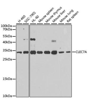CLEC7A Rabbit Polyclonal Antibody