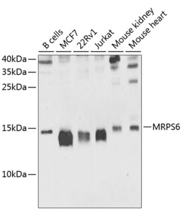 MRPS6 Rabbit Polyclonal Antibody