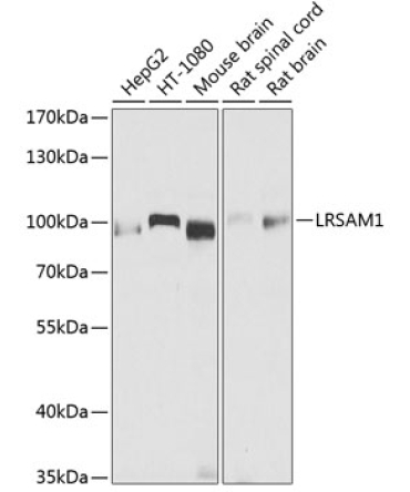 LRSAM1 Rabbit Polyclonal Antibody