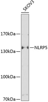 NLRP5 Rabbit Polyclonal Antibody