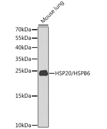 HSP20/HSPB6 Rabbit Polyclonal Antibody