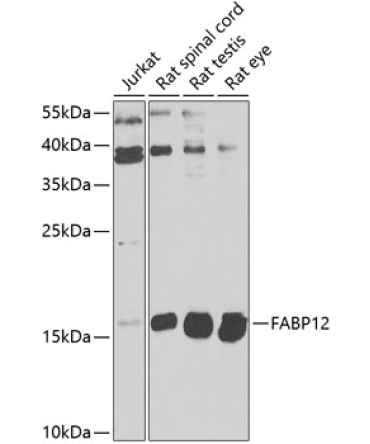 FABP12 Rabbit Polyclonal Antibody