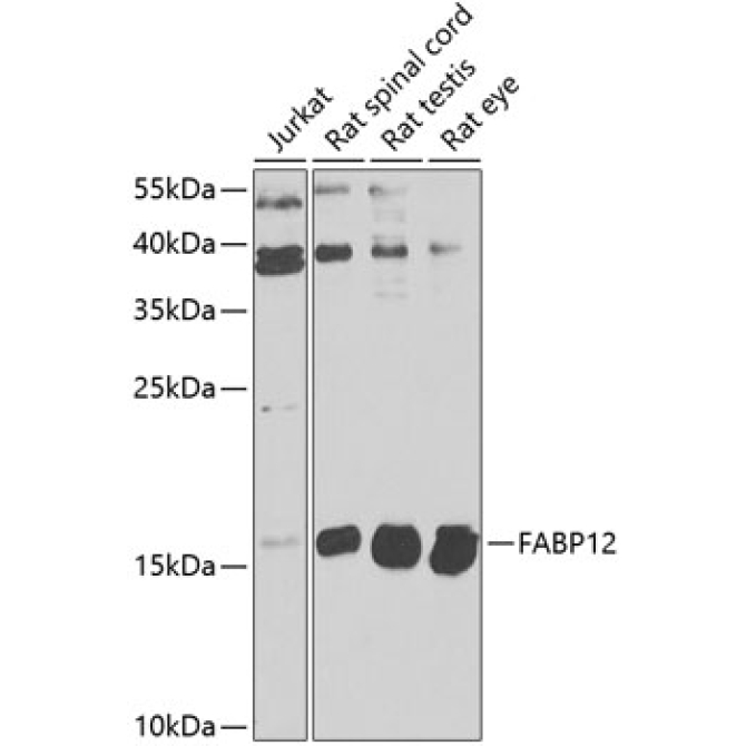 FABP12 Rabbit Polyclonal Antibody