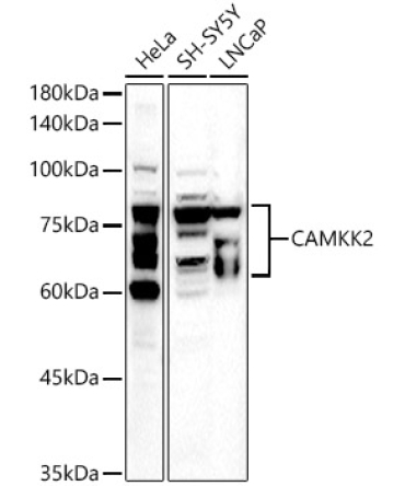 CAMKK2 Rabbit Polyclonal Antibody