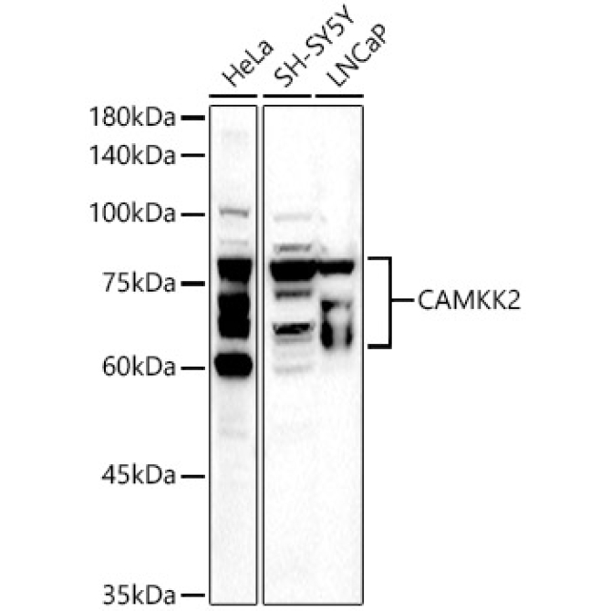 CAMKK2 Rabbit Polyclonal Antibody