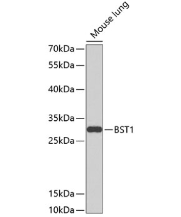 BST1 Rabbit Polyclonal Antibody