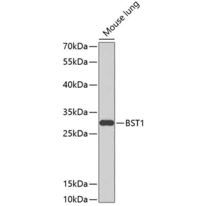 BST1 Rabbit Polyclonal Antibody