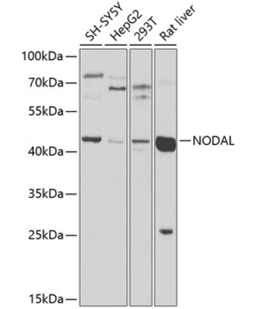 NODAL Rabbit Polyclonal Antibody