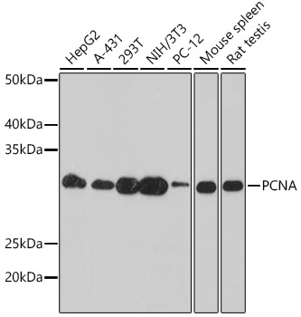 PCNA Mouse Monoclonal Antibody