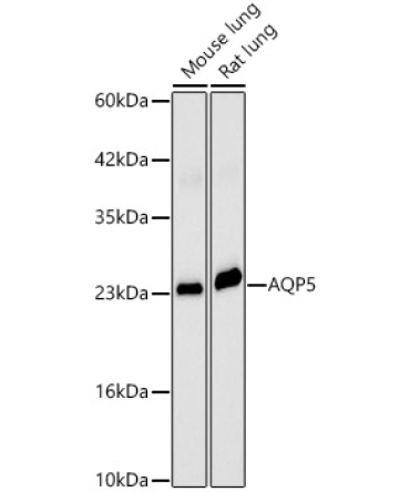 AQP5 Rabbit Polyclonal Antibody