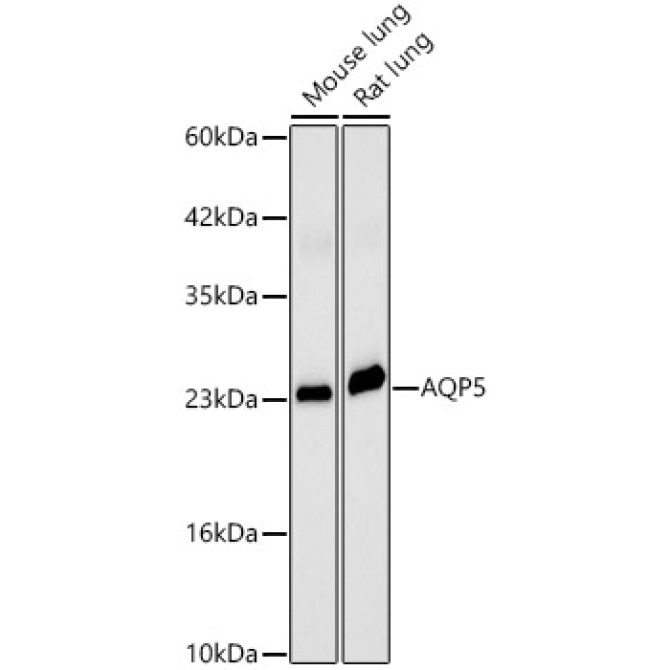 AQP5 Rabbit Polyclonal Antibody