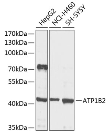 ATP1B2 Rabbit Polyclonal Antibody