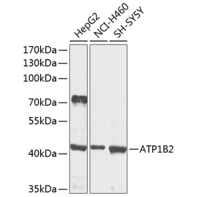 ATP1B2 Rabbit Polyclonal Antibody