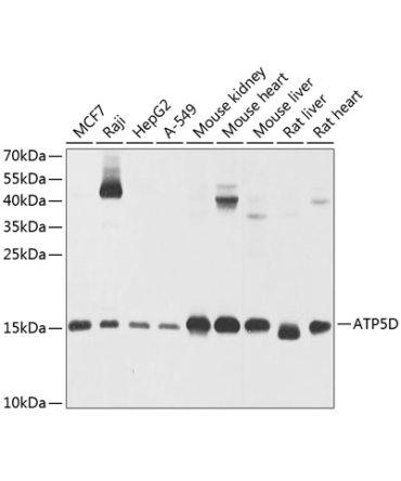 ATP5D Rabbit Polyclonal Antibody
