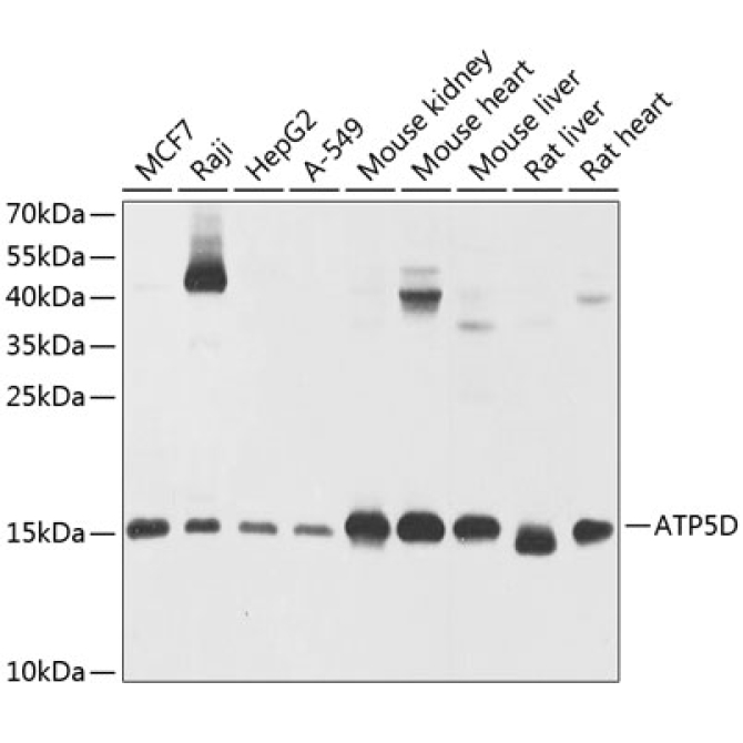 ATP5D Rabbit Polyclonal Antibody