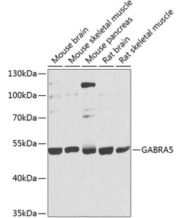 GABRA5 Rabbit Polyclonal Antibody