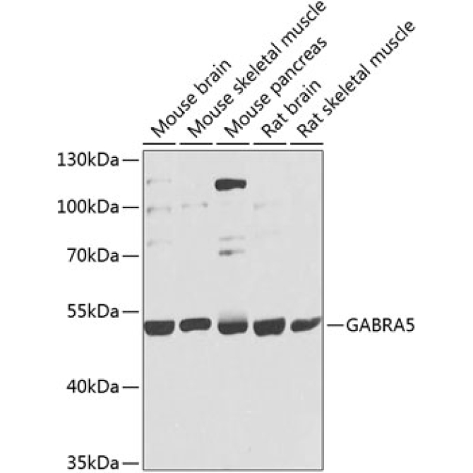 GABRA5 Rabbit Polyclonal Antibody