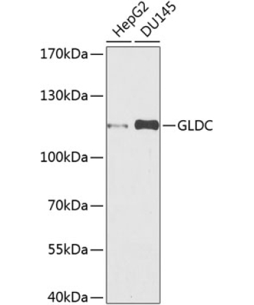 GLDC Rabbit Polyclonal Antibody