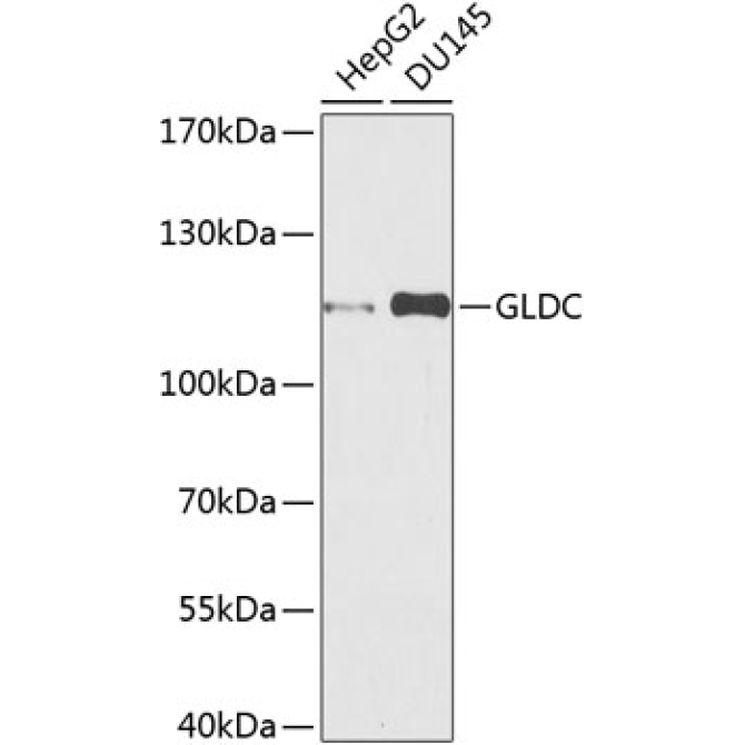 GLDC Rabbit Polyclonal Antibody