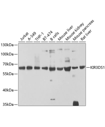KIR3DS1 Rabbit Polyclonal Antibody