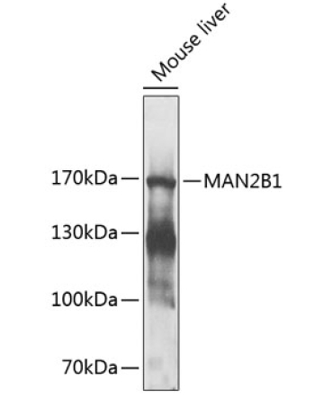 MAN2B1 Rabbit Polyclonal Antibody