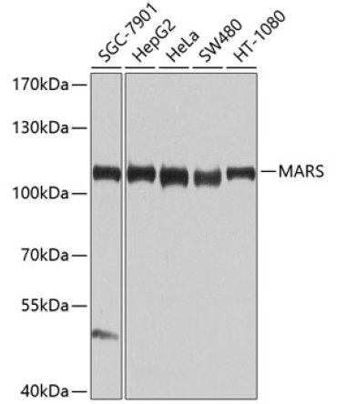MARS Rabbit Polyclonal Antibody
