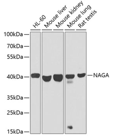 NAGA Rabbit Polyclonal Antibody