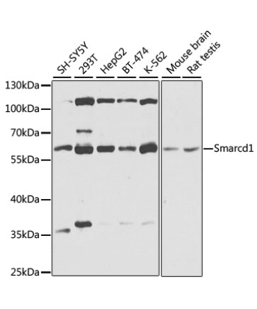 BAF60a Rabbit Polyclonal Antibody