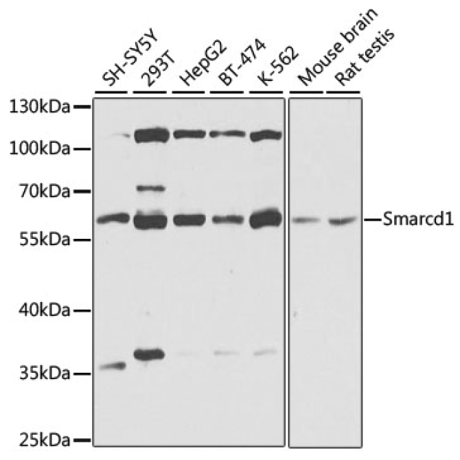 BAF60a Rabbit Polyclonal Antibody