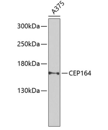 CEP164 Rabbit Polyclonal Antibody