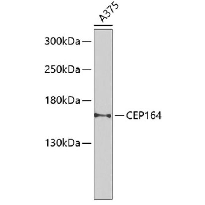 CEP164 Rabbit Polyclonal Antibody