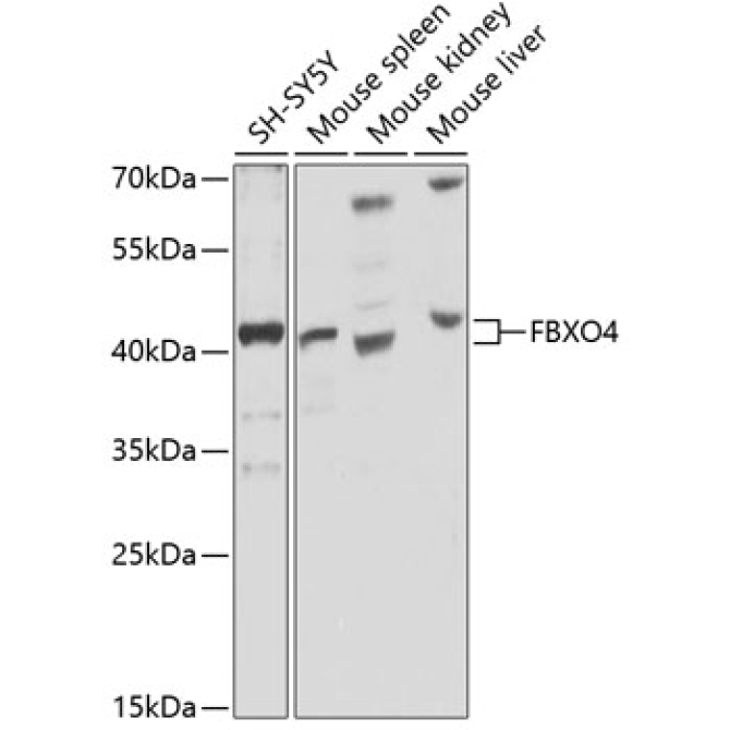 FBXO4 Rabbit Polyclonal Antibody