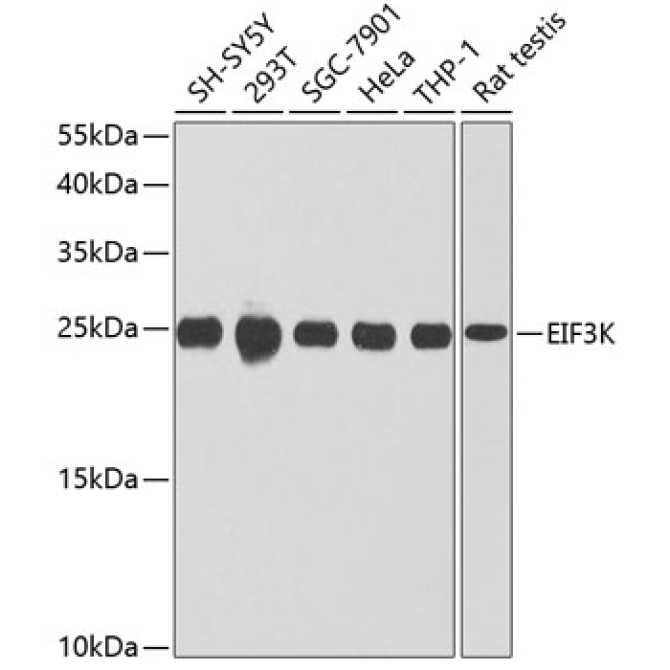 EIF3K Rabbit Polyclonal Antibody