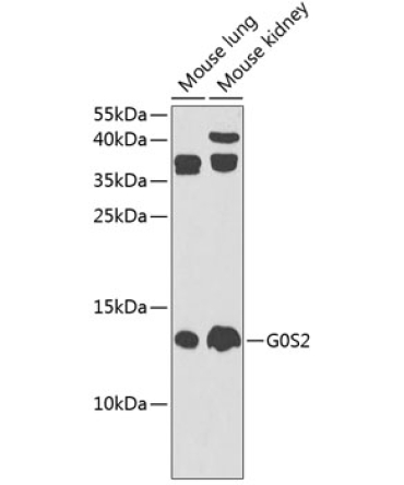 G0S2 Rabbit Polyclonal Antibody