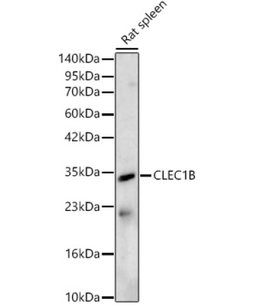 CLEC1B Rabbit Polyclonal Antibody