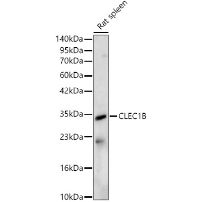 CLEC1B Rabbit Polyclonal Antibody