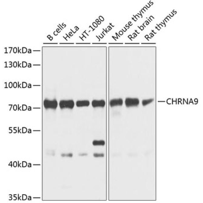 CHRNA9 Rabbit Polyclonal Antibody