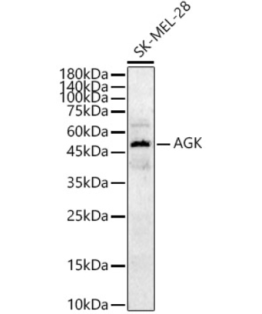 AGK Rabbit Polyclonal Antibody