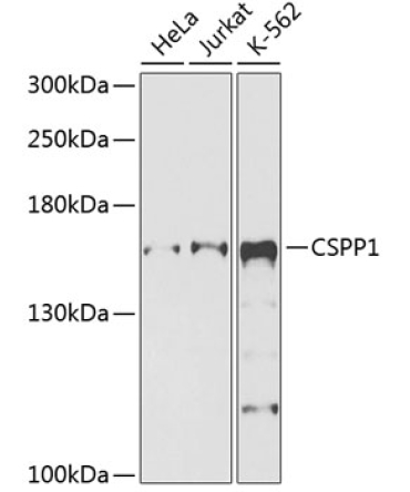 CSPP1 Rabbit Polyclonal Antibody