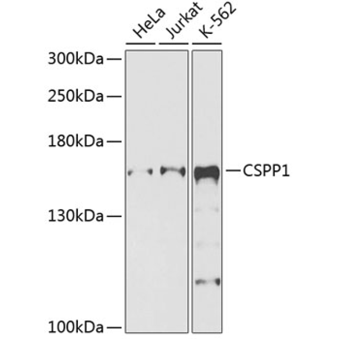 CSPP1 Rabbit Polyclonal Antibody