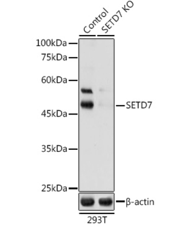 SETD7 Rabbit Polyclonal Antibody [KO Validated]