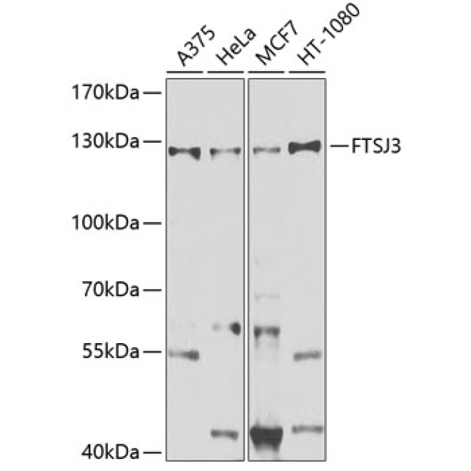 FTSJ3 Rabbit Polyclonal Antibody