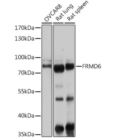FRMD6 Rabbit Polyclonal Antibody