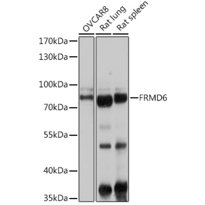 FRMD6 Rabbit Polyclonal Antibody