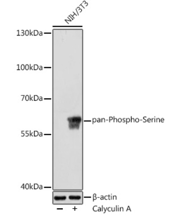 pan-Phospho-Serine Rabbit Polyclonal Antibody